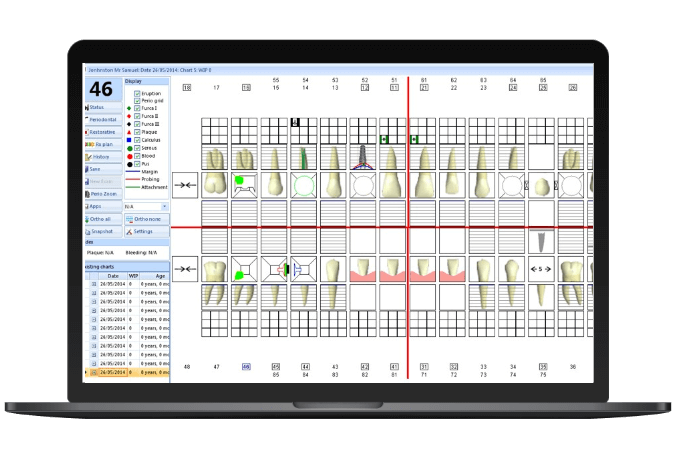 Software per chirurgia guidata